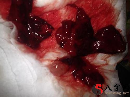 梦见自己流产了还有血